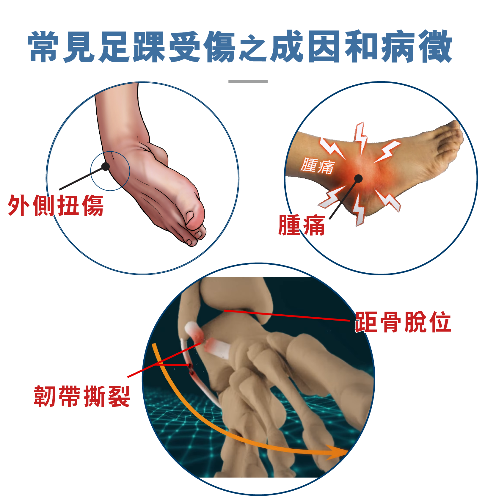 Medex stirrup ankle brace (A09b)