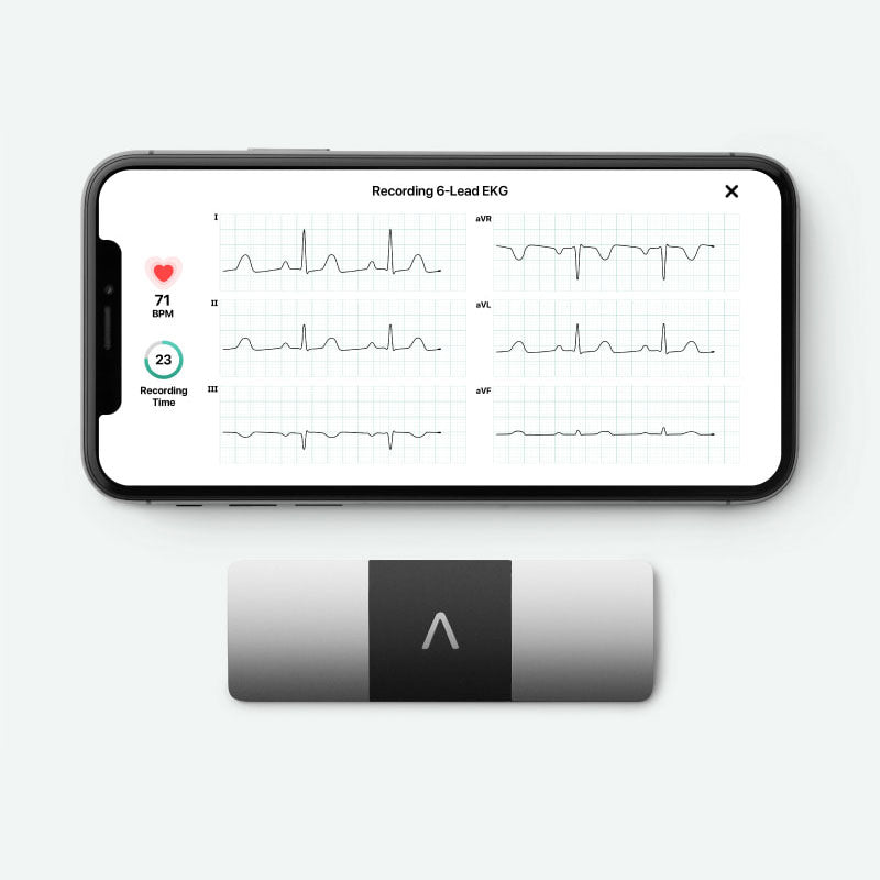 AliveCor Kardia Mobile 6L 導聯移動心電圖機