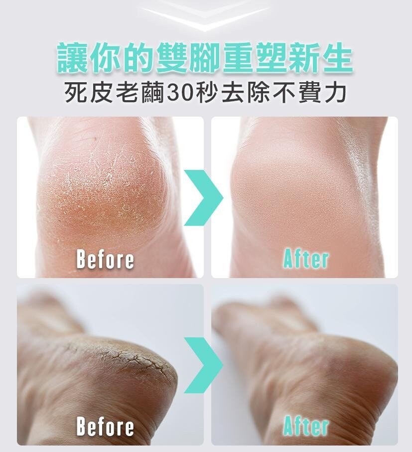 Future Lab - 6S 手足修磨儀|電動去腳皮機|磨皮機|去死皮機|足部護理|美足儀