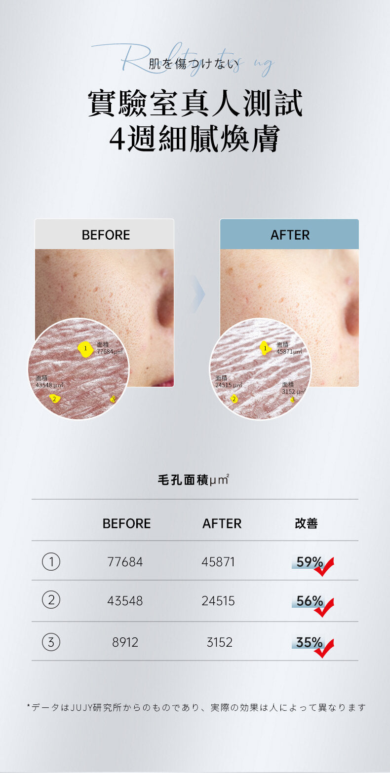 Jujy - 超音波極致淨顏彩光鏟皮機|去黑頭|收毛孔|去角質|補水保濕|提拉緊致|導出導入