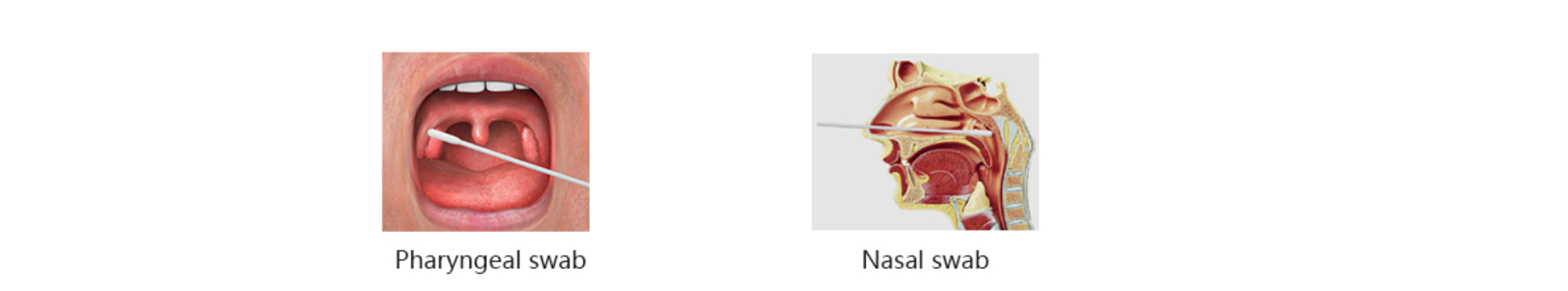 DEEPBLUE Influenza A+B & COVID-19(SARS-CoV-2) Antigen Test Kit