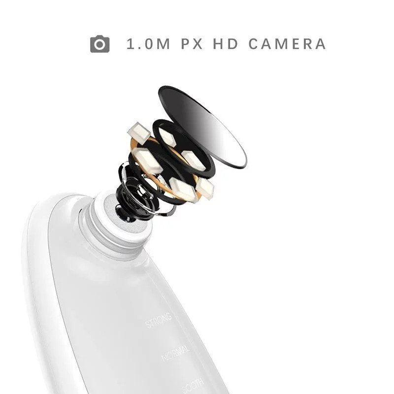 Levetop - Smart Visual Blackhead Removal Machine