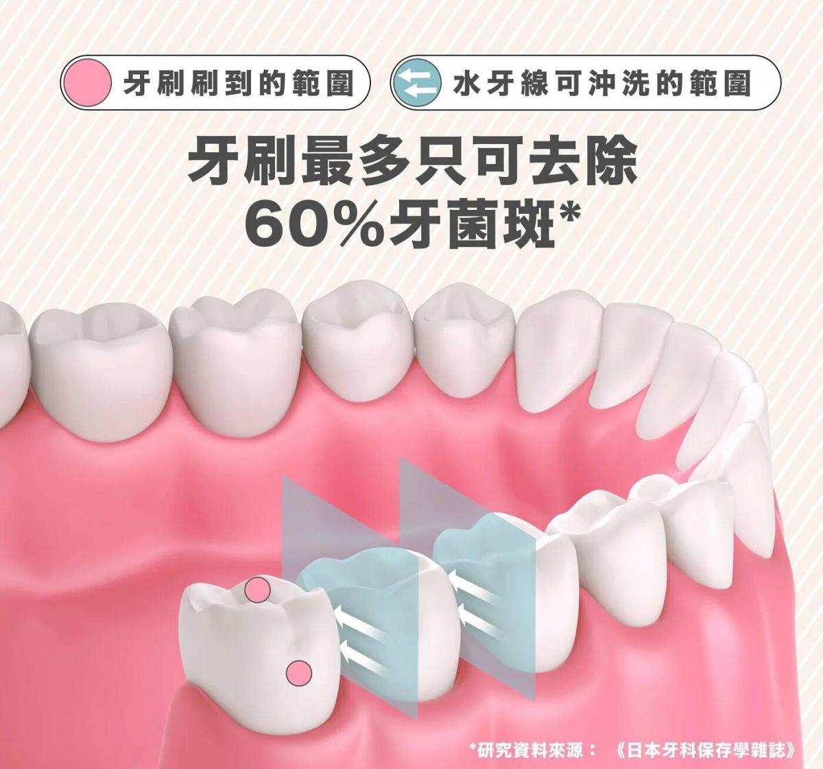 b.bellus - 便攜式水の牙線|電動水牙線|沖牙器|無線|沖牙機|可伸縮 BB0004