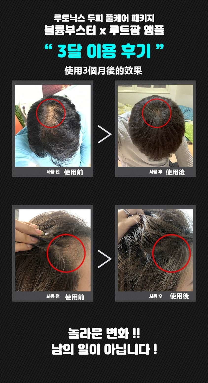 Rootonix - Rootonix Volume Booster 無線LED生髮儀 RT-01【香港行貨】