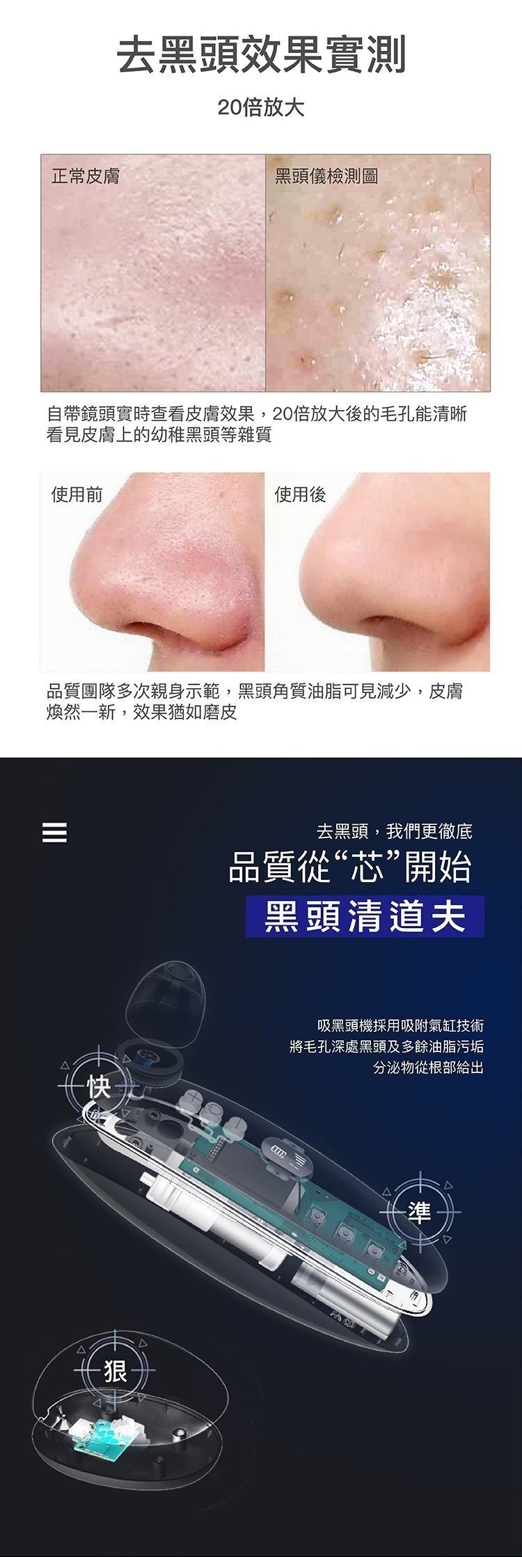 Vita-lité - Cordless blackhead suction machine