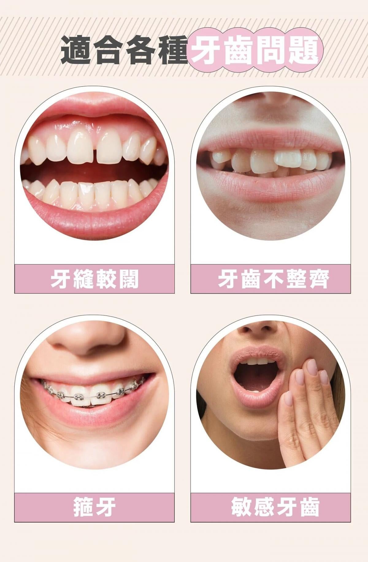 b.bellus - 便攜式水の牙線|電動水牙線|沖牙器|無線|沖牙機|可伸縮 BB0004