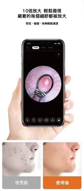 Sunuo - EarHealth FindX 3合1智能可視清潔儀|採耳|擠暗瘡粉刺|撩牙|耳挖|潔牙儀