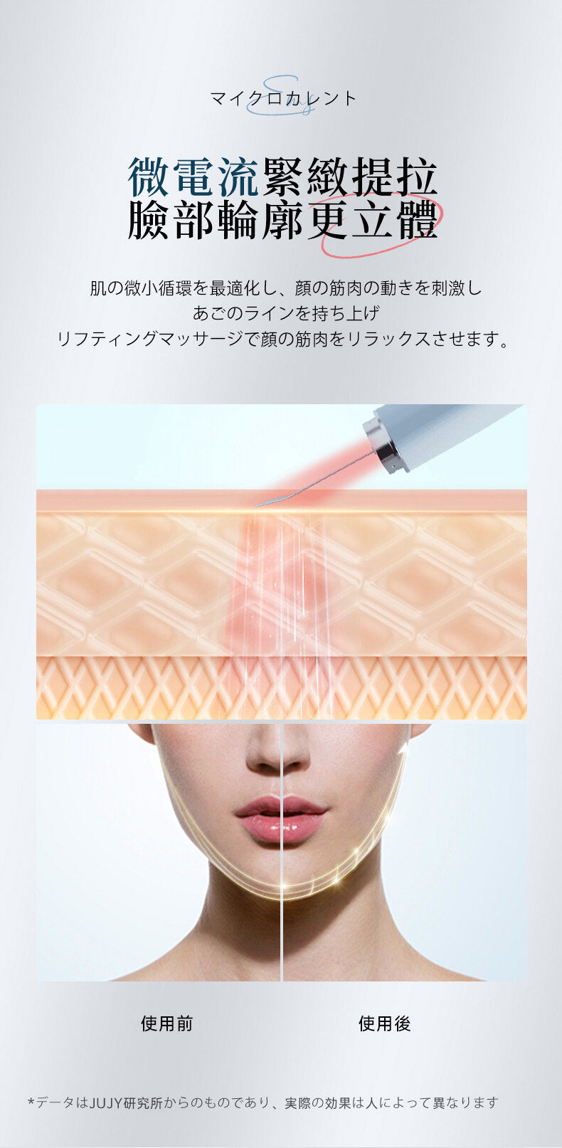 Jujy - 超音波極致淨顏彩光鏟皮機|去黑頭|收毛孔|去角質|補水保濕|提拉緊致|導出導入