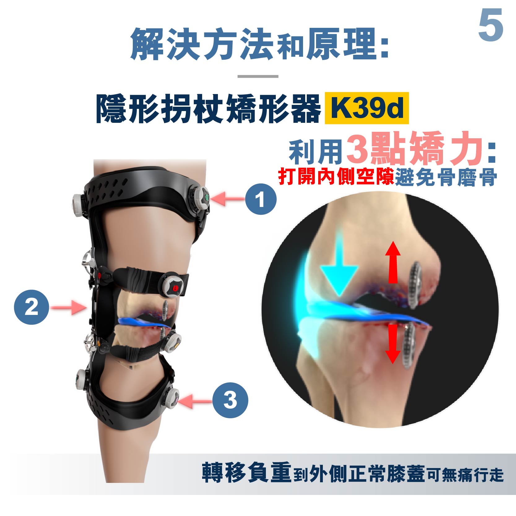 Medex invisible crutches (O-shaped knee orthosis) (K39d)