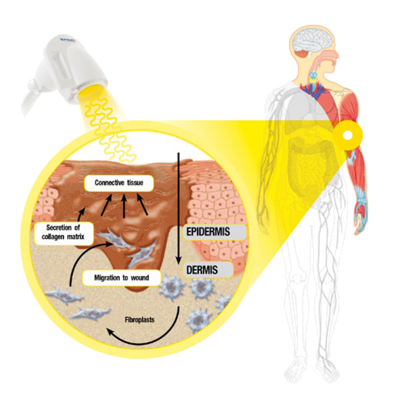 Bioptron MedAll Light Therapy 拜爾康活彩偏光燈(輕巧型)