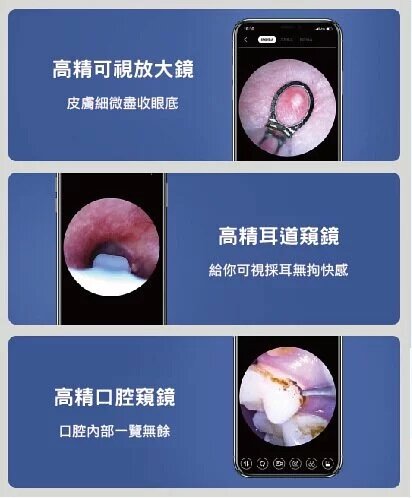 Sunuo - EarHealth FindX 3合1智能可視清潔儀｜採耳｜擠暗瘡粉刺｜撩牙｜耳挖｜潔牙儀