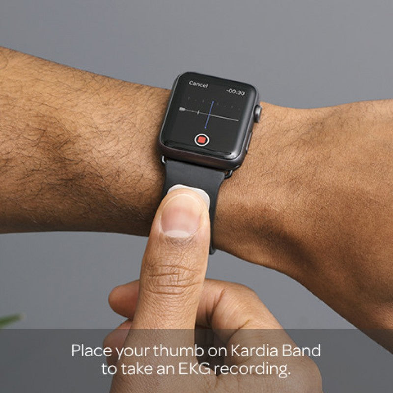 Alivecor Kardia Band (38mm)